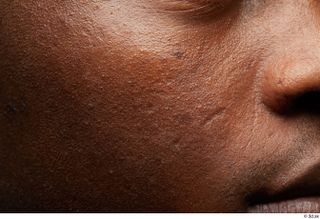  HD Face Skin Kavan cheek face scar skin pores skin texture 0003.jpg